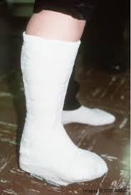Total Contact Casting It Cast Wound Care Diabetic Feet