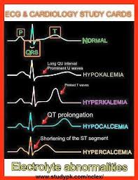 Nursing Ecg Cardiology Study Cards Electrolyte Abnormalities Studypk Nursing Mnemonics Cardiology Study Cardiac Nursing