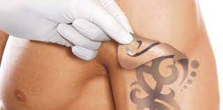 Dragon tattoos and applications for women. Lazerle Dovme Sildirme Fiyatlari Dr Nilgun Soysal Ankara