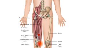 Related online courses on physioplus. Trigger Point Therapy Patellofemoral Pain Syndrome Runner S Knee Is Often Associated With Trigger Points In The Quadriceps Muscles Https Bit Ly 2tnk46s Facebook