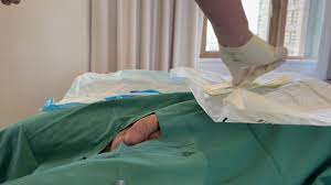 Male Medical Exam and Catheter - ThisVid.com на русском