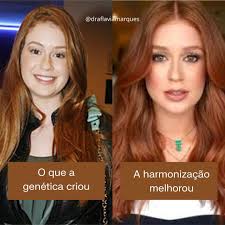 ✨A beleza é genética, mas o glow… esse a gente turbina por aqui! 😏 A  harmonização facial não muda quem você é — ela só realça o que você já tem  de