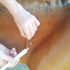 Image result for Lower Cervical Intramuscular Injection