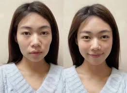 永远不要把“整容”和“‭抗‬衰”混为一谈“整容”是换一张脸“抗衰”是维持‭不老春青‬容颜🧏 多年以后你依然‭是还‬那么年轻、‭精‬致