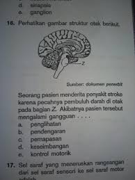 Artikel dan berita tentang contoh soal bahasa in. Soal Biologi Ttg Sistem Saraf Manusia Kelas Xi Brainly Co Id