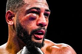 Boxing from Windsor Park in Belfast
