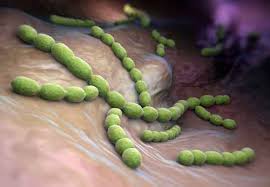 Pneumonia bacteriană este o boală infecțioasă a plămânilor, cu rate ale morbidității și mortalității foarte ridicate, în special în rândul pacienților cu risc crescut (vârsta și condițiile de sănătate ale. Pneumonia Bacteriana
