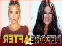 Khloé kardashian slams commenter who accuses her of looking 'like an alien' from plastic surgery. Khloe Kardashian Before Surgery Nickelimages