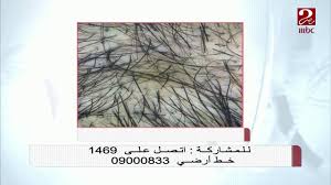 تجنب عادة شد الشعر لخطورته تعرف على المزيد Youtube