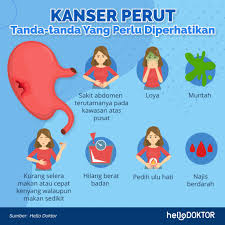 We did not find results for: Sakit Perut Berpanjangan Tanda Kanser Perut Semak 11 Simptom Ini