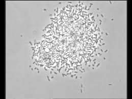 Maybe you would like to learn more about one of these? Bacillus Bacteria Colony In Formation Under A Microscope Youtube