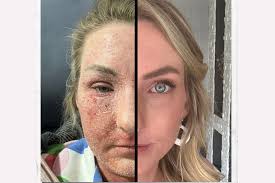 Fundraiser by Amy A : Half marathon for TSW research