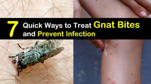 We did not find results for: 7 Quick Ways To Treat Gnat Bites And Prevent Infection