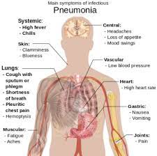 Pneumonia: Recovery & Complications | Study.com