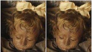 Rosalia's father, official mario lombardo, was sorely grieved upon her death, so he approached alfredo salafia, a noted embalmer, to preserve her. Disebut Mumi Terindah Simak Kisah Hidup Rosalia Lombardo Yang Dijuluki Sleeping Beauty Banjarmasin Post