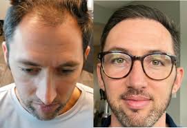 Matthew Huebner, MD, Physician