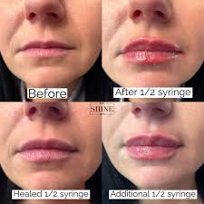 Alyssa Rowe, FNP-BC (@alyssarowe_np) • Instagram photos and videos