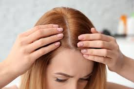 This type of hair loss occurs (in both men and women) when the hair follicle shrinks so much over time that it doesn't grow new hair. What Causes Hair Loss In Women