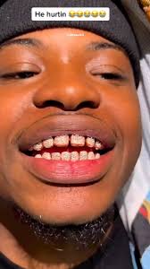 Thanks, i hate people who shave their teeth down to get permanent diamond  grillz