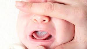 Ada juga yang memunyai masalah sebegini hanya pada bulan ramadhan sahaja. Bukan Salah Ibu Mengidam Ini 6 Punca Air Liur Bayi Asyik Meleleh