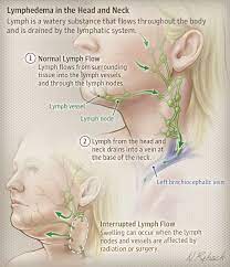 Maybe you would like to learn more about one of these? 9 Drain Lymphatic System Ideas In 2021 Lymphatic System Lymphatic Lymph Massage