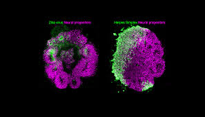Jun 03, 2021 · a team of colorado state university scientists, led by veterinary postdoctoral fellow dr. Brain Organoids Uncover Various Mechanisms Of Virus Induced Microcephaly