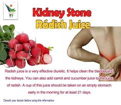 Radish Juice For Kidney Stone Juice Fast Juicing Benefits Natural Health Remedies