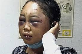 Description i am from kuala lumpur ,malaysia. Another Maid Died From Abuse In Malaysia And She Probably Won T Be The Last Here S Why