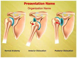 Image result for Shoulder Presentation