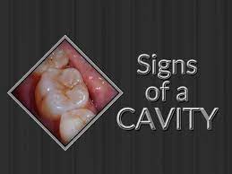 Pin On Montclair Dental Tips