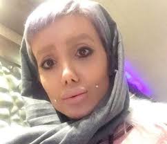 The actress has never confirmed that she's gotten a nose job, but multiple plastic surgeons have said that it looks like she's had a rhinoplasty . Dlisted The Zombie Angelina Jolie Girl Lied About Getting Plastic Surgery To Look Like Her Idol
