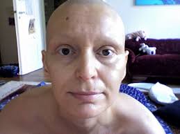 Wimpern wachsen, wie alle körperhaare, selbstverständlich nach. Oben Ohne Alle Haare Wieder Stern De