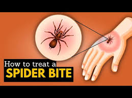 Image result for Spider Bite