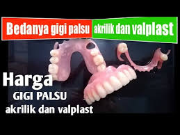 Check spelling or type a new query. Bedanya Gigi Palsu Akrilik Dan Gigi Palsu Valplast Part 3 Youtube