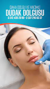 Dudak Dolgusu Lip Augmentation Herion Poliklinigi Dudak Blog Estetik