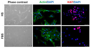 In der ecke links steht ein fernseher. Cells Free Full Text Tissue Specific Differentiation Of Human Chondrocytes Depends On Cell Microenvironment And Serum Selection Html