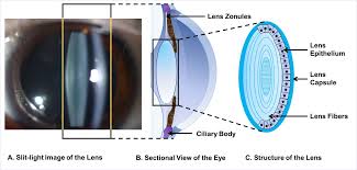 Structure Of The Lens And Its Associations With The Visual Quality Bmj Open Ophthalmology