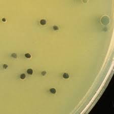 We did not find results for: Lab M Media Selectively Identify Clostridium Perfringens