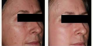 Mark H. Tseng, MD, Physician