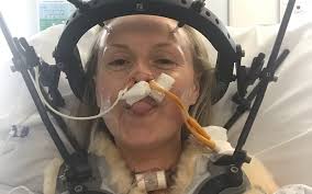 Geoffrey Jefferson Brain Research Centre