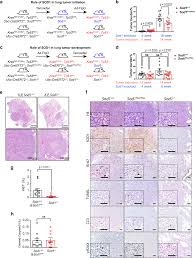 A dark blue ribbon, on the other hand, represents colon cancer which is more common to males. Sod1 Regulates Ribosome Biogenesis In Kras Mutant Non Small Cell Lung Cancer Nature Communications