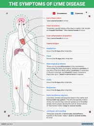 Here S How To Know If You Have Lyme Disease Business Panama City News Herald Panama City Fl