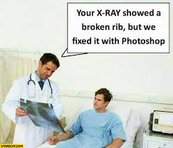 If you have any questions regarding the license or the reuse of the image, please contact me before using it. Doctor Your X Ray Showed Broken Rib But We Fixed It With Photoshop Starecat Com