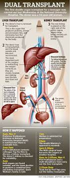 Pin On Transplantation