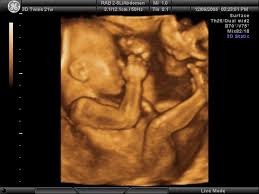 Ultraschall in 3d erlaubt lebensechte bilder von ihrem baby schon während der schwangerschaft. Frauenarzt Gynakologe Dr Med Dorffler Affoltern Am Albis 3d Live 4 D Ultraschall