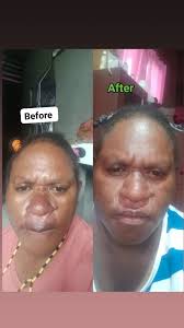 Marketplace Kota Medan