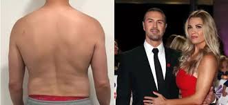 Aug 31, 2020 · when peter kay was back in the spotlight, he had an impressive physique. Paddy Mcguinness Paddy Mcguinness 45 Goes Topless To Reveal Amazing Two Stone Weight Loss Weight Loss