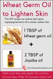 Pin On Healthy Ideas