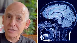 Eye doctor issues warning over the absolute worst thing you can do to your  eyes