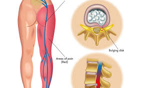 It is used to describe the lateral sides of a region, which in humans are often symmetrical around the center of the body. Lower Back Organs Anatomy Anatomy Drawing Diagram